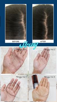 Gambar Organic Hair Growth nutrient & Scalp Treatment serum dari Dermaskin.shop undefined 3 Tokopedia