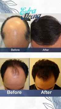 Gambar Organic Hair Growth nutrient & Scalp Treatment serum dari Dermaskin.shop undefined 2 Tokopedia