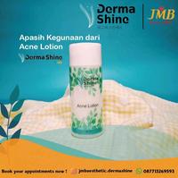 Gambar DERMA SHINE ACNE LOTION PELEMBAB KULIT JERAWAT BERMINYAK dari Dermashine undefined 1 Tokopedia