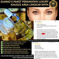 Gambar Magic Eye Cream (Cream Mata Ampuh) dari ELNINO'S BEAUTY undefined 1 Tokopedia