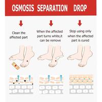 Gambar Foot Corn Removal Patch Plester Koyo Ampuh Hilangkan Kutil Mata Ikan dari DakenShopp undefined 3 Tokopedia