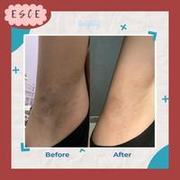 Gambar BRIGHTY Glowing Underarm Gel Scrub Pemutih Ketiak Odor Deodorant - Scrub dari SHOPESCE undefined 5 Tokopedia