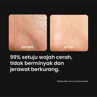 Gambar ORIGINAL Masker Wajah Captain Cerahkan,cegah jerawat dan minyak Wajah dari depanlaptop undefined 5 Tokopedia