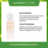 Gambar Jglow Acne Lotion dari JGLOW BEAUTY ID undefined 2 Tokopedia