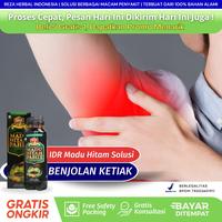 Gambar OBAT BENJOLAN DIKETIAK - IDR MADU HITAM dari Reza Herbal ID undefined 1 Tokopedia