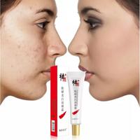 Gambar Cream Penghilang Flek Cindynal Cream Penghilang Jerawat Cream Penghila dari Shopaholicurban undefined 1 Tokopedia