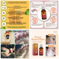 Gambar OBAT KELOID PALING AMPUH TERBUKTI!OBAT PENGHILANG BEKAS LUKA OBAT BPOM - 1paket dari ALISHA STORE. undefined 3 Tokopedia