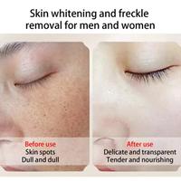 Gambar Cream Penghilang Flek Cindynal Cream Penghilang Jerawat Cream Penghila dari Shopaholicurban undefined 3 Tokopedia