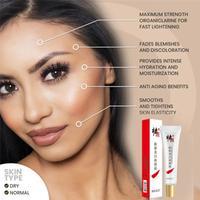 Gambar Cream Penghilang Flek Cindynal Cream Penghilang Jerawat Cream Penghila dari Shopaholicurban undefined 5 Tokopedia
