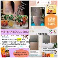Gambar OBAT KELOID PALING AMPUH TERBUKTI!OBAT PENGHILANG BEKAS LUKA OBAT BPOM - 1paket dari ALISHA STORE. undefined 5 Tokopedia