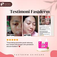 Gambar FAST DERM PAKET ACNE GLOWING BASIC FREE POUCH & GIFT dari Fast Derm. Official Shop undefined 5 Tokopedia