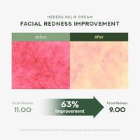Gambar Milk Touch Hedera Helix Relaxing Cream 50ml ( Krim Wajah ) dari Hitshop ID undefined 5 Tokopedia