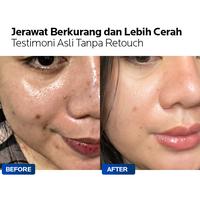 Gambar Aizen Hyorin Infusion Essence Toner - Toner Wajah Multi Fungsi - 1Pcs➠1Bulan dari Aizen Dermalogy undefined 5 Tokopedia