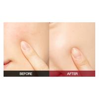 Gambar Holika Holika Enprani Retino X8 Pro Extra Repair Solution | Serum dari Holika Holika Indonesia undefined 5 Tokopedia