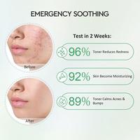 Gambar GLAD2GLOW 2% Salicylic Acid Overnight Acne Spot Cream Treatment 5g dari madame fany undefined 3 Tokopedia