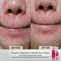 Gambar Centifolia Rose Water 500ml dari Beautyganics undefined 4 Tokopedia
