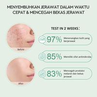 Gambar Glad2Glow 2% Salicylic Acid Overnight Acne Spot Treatment dari angelbeauty1 undefined 3 Tokopedia