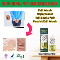 Gambar Obat Kutil Kelamin Daging Tumbuh Gatal & Perih Perontok Kutil Kelamin. dari HERBAL RESMII undefined 1 Tokopedia