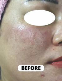 Gambar Serum Anti Aging Gold Dear Dream Bright and Glow Series dari Dear Dream Pusat Official Store undefined 5 Tokopedia
