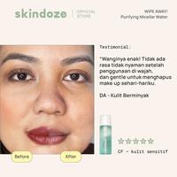 Gambar SKINDOZE Micellar Water 200 ml +  Move On Acne Spot Treatment dari Skindoze undefined 3 Tokopedia