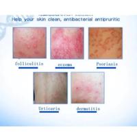 Gambar Salep Kulit Chy Gao Zudaifu / Salep Alergi Kulit Jamur kurap dari hentree.id undefined 4 Tokopedia