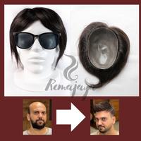 Gambar Tutup botak Toupee pria natural 20cm Skin - 18x15 dari Remajaya Hair undefined 1 Tokopedia