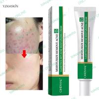 Gambar CINDYNAL Obat Jerawat Yang Ampuh Menghaluskan & Mengurangi Gatal dari Toko Baru 3 undefined 1 Tokopedia