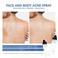 Gambar ACNAWAY Acne Face and Body Spray Spray Jerawat dari Olshopcherrish undefined 4 Tokopedia