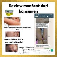 Gambar Sabun Gatal Kulit Ampuh Fahesa Skin Kulit Sensitif Jamur Batang Asli dari as syifa herbal Depok undefined 3 Tokopedia