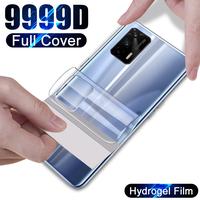 Gambar ANTIGORES HYDROGEL CLEAR/BENING REALME 10 / 10 T / 10 S / 10 PRO / 10 - DEPAN, REALME 10 dari Mr.case store undefined 4 Tokopedia