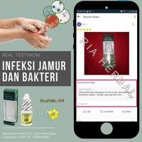 Gambar SALEP UNTUK PANTAT GATAL BRUNTUSAN OBAT JERAWAT DI BOKONG FUNGAL ACNE dari Ria Herbal Official undefined 4 Tokopedia