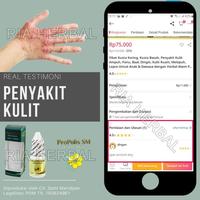 Gambar SALEP UNTUK PANTAT GATAL BRUNTUSAN OBAT JERAWAT DI BOKONG FUNGAL ACNE dari Ria Herbal Official undefined 2 Tokopedia