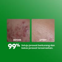 Gambar NPURE Face Toner Centella Asiatica 150ML dari Twocare undefined 3 Tokopedia
