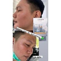 Gambar News Wg Glow Skincare Strong Series dari wardahshop0987 undefined 5 Tokopedia