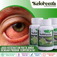 Gambar Obat Glaukoma Sakit Mata Merah Penglihatan Kabur Keloreena - 100 Kapsul dari WALATRA HERBAL INDO undefined 1 Tokopedia