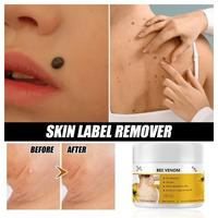 Gambar Bee Venom Removar Cream Krim Penghilang Tahi Lalat Obat Tahi Lalat Salep Ampuh Penghilang Kutil Permanen dari KQ5 BEAUTY undefined 4 Tokopedia