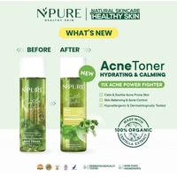 Gambar Npure Toner Centella Asiatic Acne Clear Hydrating & Calming Toner 30 ml & 150 ml Hypoallergenic - 150ml dari PATCHSTATION undefined 1 Tokopedia