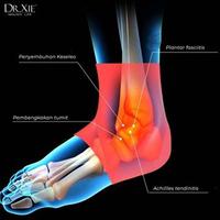 Gambar Ankle Support/Pelindung Engkel Kaki/Ankle Support Wrap Brace Pelindung Tumit Kaki Adjustable/Pelindung Tumit dari Dr Xie Healthy Life undefined 5 Tokopedia