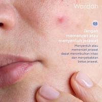 Gambar NEW Paket Wardah Acnederm Series Complete Package - Paket Acne Skin Care - 5 in 1 (5pcs) dari yinyin_store undefined 4 Tokopedia