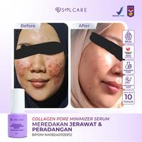 Gambar Solcare Collagen Pore Minimizer Serum + DNA Salmon & Biome – Serum Penghilang Bopeng & Pengecil Pori - Pore minimizer dari Solcare.id undefined 5 Tokopedia