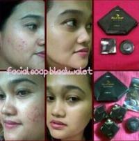 Gambar SABUN WAJAH BLACK WALET BPOM MENGHILANGKAN JERAWAT FLEK HITAM BEKAS LUKA N=MENCERAHKAN KULIT WAJAH dari GOODJOOBS undefined 4 Tokopedia