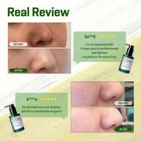 Gambar SOME BY MI BYE BYE BLACKHEAD 30 DAYS MIRACLE GREEN TEA TOX BUBBLE CLEANSER | 120GR | SOMEBYMI | BPOM dari MIZU-SHOP undefined 5 Tokopedia