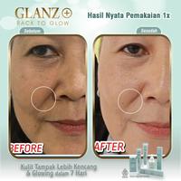 Gambar Glanz Edelweiss Skincare Series All Varian Glanz+ Mengandung dna salmon with Salmon Ovary Peptide Best Seller KK Indonesia - Facial foam dari Kkstore indonesia undefined 5 Tokopedia