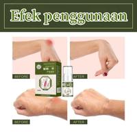 Gambar APGAR Obat Semprot Nyeri Sendi Reumatik Bengkak dari Female angel shop undefined 2 Tokopedia