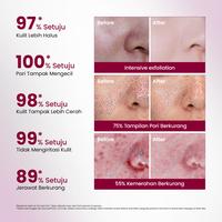 Gambar [NEW LAUNCH] YOU 12% ACID INTENSIVE PEELING SERUM BUNDLE AHA BHA PHA Serum Eksfoliasi Untuk Kulit Cerah dan Halus - Serum 12%x2pcs dari YOU Beauty Official undefined 4 Tokopedia