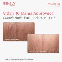 Gambar GENTLY Mamacare Twinpack Stretchmark Cream dari GENTLY Baby undefined 3 Tokopedia