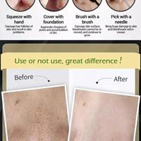 Gambar Rakoso LANBENA Penghilang Komedo Hidung Hitam Masker Wajah Paling Ampuh ## dari Doinix undefined 5 Tokopedia