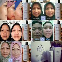 Gambar op Trulum Cream Pemutih Wajah Aman Untuk Ibu Hamil Dan Menyusui vi dari Azaliaselli Stored undefined 5 Tokopedia