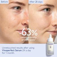 Gambar Caudalie Vinoperfect Radiance / Brightening Dark Spot Serum - 10ml dari naturalbeautystuff undefined 3 Tokopedia