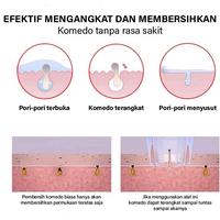 Gambar Alat Penyedot Komedo dan Jerawat / Vacum Pembersih Komedo Wajah Blackhead Remove MURAH dari lilishopma undefined 5 Tokopedia